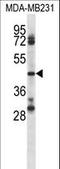 CD84 Molecule antibody, LS-C168570, Lifespan Biosciences, Western Blot image 