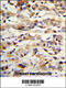 Keratin 14 antibody, 62-420, ProSci, Immunohistochemistry paraffin image 
