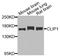 CAP-Gly Domain Containing Linker Protein 1 antibody, A08907-1, Boster Biological Technology, Western Blot image 