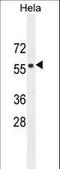 F-Box And WD Repeat Domain Containing 8 antibody, LS-C166096, Lifespan Biosciences, Western Blot image 