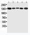 Regulator Of G Protein Signaling 3 antibody, LS-C313176, Lifespan Biosciences, Western Blot image 