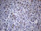 THAP Domain Containing 8 antibody, M18548, Boster Biological Technology, Immunohistochemistry paraffin image 