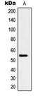 Peripherin antibody, orb214461, Biorbyt, Western Blot image 