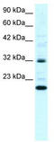 Rho GDP Dissociation Inhibitor Gamma antibody, TA334303, Origene, Western Blot image 