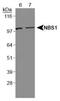 Nibrin antibody, PA5-22975, Invitrogen Antibodies, Western Blot image 
