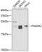 Pleckstrin Homology Like Domain Family A Member 2 antibody, A04912, Boster Biological Technology, Western Blot image 