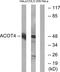 Acyl-CoA Thioesterase 4 antibody, GTX87881, GeneTex, Western Blot image 