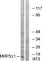 Mitochondrial Ribosomal Protein S21 antibody, TA315524, Origene, Western Blot image 