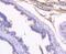 Kallikrein Related Peptidase 3 antibody, A01505-2, Boster Biological Technology, Immunohistochemistry paraffin image 