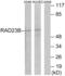 RAD23 Homolog B, Nucleotide Excision Repair Protein antibody, abx015030, Abbexa, Western Blot image 