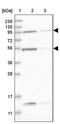 VPS53 Subunit Of GARP Complex antibody, PA5-54656, Invitrogen Antibodies, Western Blot image 