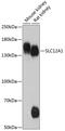 Solute Carrier Family 12 Member 1 antibody, 14-736, ProSci, Western Blot image 