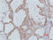 Signal Transducer And Activator Of Transcription 2 antibody, STJ97433, St John