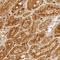 Alpha 2-HS Glycoprotein antibody, NBP1-90302, Novus Biologicals, Immunohistochemistry frozen image 
