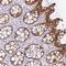 General Transcription Factor IIH Subunit 3 antibody, NBP2-30407, Novus Biologicals, Immunohistochemistry frozen image 