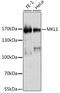 Myocardin Related Transcription Factor A antibody, GTX64556, GeneTex, Western Blot image 