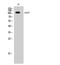 EPH Receptor A7 antibody, STJ96385, St John