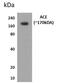 Angiotensin I Converting Enzyme antibody, GTX52523, GeneTex, Western Blot image 