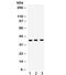 Surfactant Protein D antibody, R32075, NSJ Bioreagents, Western Blot image 