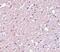 Transmembrane Protein 184A antibody, NBP1-77142, Novus Biologicals, Immunohistochemistry paraffin image 