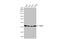 TAR DNA Binding Protein antibody, GTX114210, GeneTex, Western Blot image 