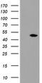 Tryptophan 2,3-Dioxygenase antibody, TA504675, Origene, Western Blot image 