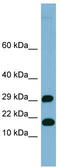 Trafficking Protein Particle Complex 2 Like antibody, TA345055, Origene, Western Blot image 