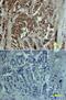 Matrix Metallopeptidase 13 antibody, AF511, R&D Systems, Immunohistochemistry paraffin image 