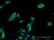 Glyceronephosphate O-Acyltransferase antibody, H00008443-D01P, Novus Biologicals, Immunocytochemistry image 
