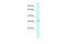 Glycine N-Methyltransferase antibody, ARP43564_P050, Aviva Systems Biology, Western Blot image 