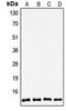 Thioredoxin antibody, MBS821748, MyBioSource, Western Blot image 