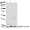 Synuclein Alpha antibody, LS-C773107, Lifespan Biosciences, Western Blot image 