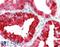 Forkhead box protein F1 antibody, 43-446, ProSci, Western Blot image 