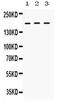 LIF Receptor Subunit Alpha antibody, PA5-79602, Invitrogen Antibodies, Western Blot image 