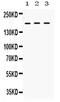 Leukemia inhibitory factor receptor antibody, PA5-79602, Invitrogen Antibodies, Western Blot image 