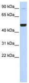 KIF2A antibody, TA334687, Origene, Western Blot image 