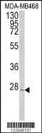 Peroxisomal membrane protein 11A antibody, MBS9210383, MyBioSource, Western Blot image 