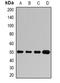 Sca3 antibody, orb377941, Biorbyt, Western Blot image 