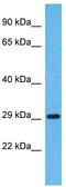 Olfactory Receptor Family 5 Subfamily H Member 14 antibody, TA337527, Origene, Western Blot image 