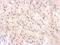 Complement Factor H antibody, LS-C185361, Lifespan Biosciences, Immunohistochemistry paraffin image 