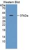 Kelch Like ECH Associated Protein 1 antibody, LS-C728560, Lifespan Biosciences, Western Blot image 