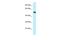 Vacuolar Protein Sorting 4 Homolog B antibody, A03403, Boster Biological Technology, Western Blot image 