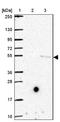 Solute Carrier Family 17 Member 7 antibody, NBP2-39000, Novus Biologicals, Western Blot image 