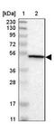 Calcium/calmodulin-dependent protein kinase type IV antibody, NBP1-88209, Novus Biologicals, Western Blot image 