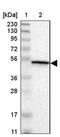 Calcium/Calmodulin Dependent Protein Kinase IV antibody, NBP1-88209, Novus Biologicals, Western Blot image 