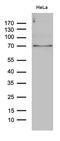 Protein Phosphatase, Mg2+/Mn2+ Dependent 1D antibody, M01576, Boster Biological Technology, Western Blot image 