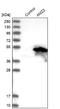 Archaelysin Family Metallopeptidase 2 antibody, NBP1-85996, Novus Biologicals, Western Blot image 