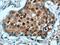 Cyclin Dependent Kinase Inhibitor 1B antibody, 25614-1-AP, Proteintech Group, Immunohistochemistry paraffin image 
