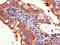 Eukaryotic Translation Initiation Factor 3 Subunit C antibody, LS-C397331, Lifespan Biosciences, Immunohistochemistry paraffin image 