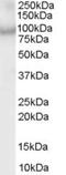 ArfGAP With Coiled-Coil, Ankyrin Repeat And PH Domains 2 antibody, MBS421076, MyBioSource, Western Blot image 